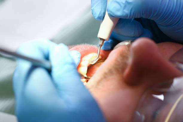 Best Emergency Dentist Near Me  in Matheny, CA
