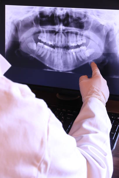 Best Tooth Infection Emergency Dentist  in Matheny, CA